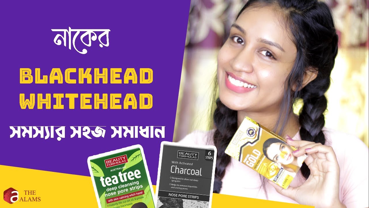 How To Easily Get Rid of Blackheads & Whiteheads With Nose Pore Strips