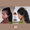 The Ordinary Multi Peptide Serum For Hair Density 5