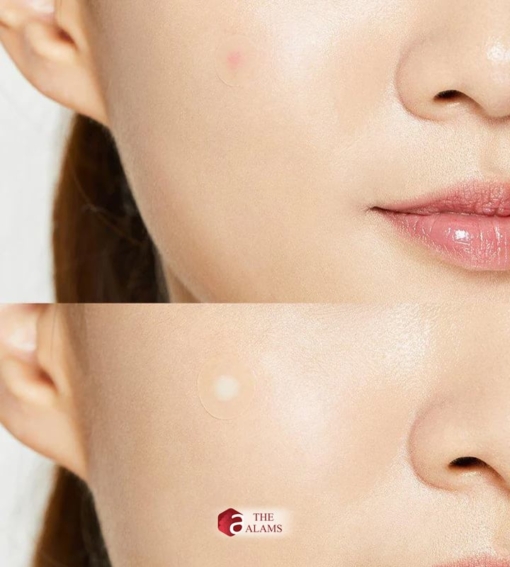 Cosrx Pimple Patch 4