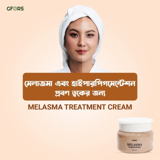 GFORS Melasma Treatment Cream 1