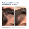 WishCare Hair Growth Serum Concentrate, 30 ml 8 WishCare Hair Growth Serum Concentrate 5