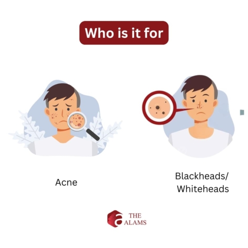 Who is it for acne blackheads