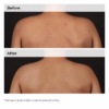 The Ordinary Salicylic Acid 0.5 Body Serum 1