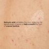 The Ordinary Salicylic Acid 0.5 Body Serum 3