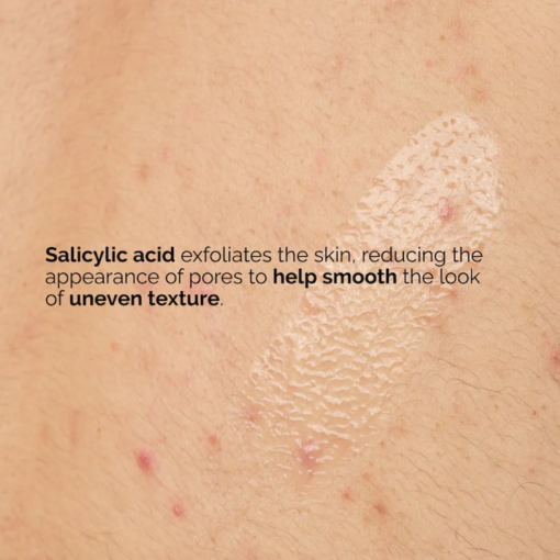 The Ordinary Salicylic Acid 0.5% Body Serum, 240 ml - Image 4