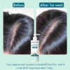 Wishcare AHA BHA Anti Dandruff Shampoo 250 ml 1