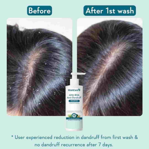 Wishcare AHA BHA Anti Dandruff Shampoo, 250 ml - Image 2