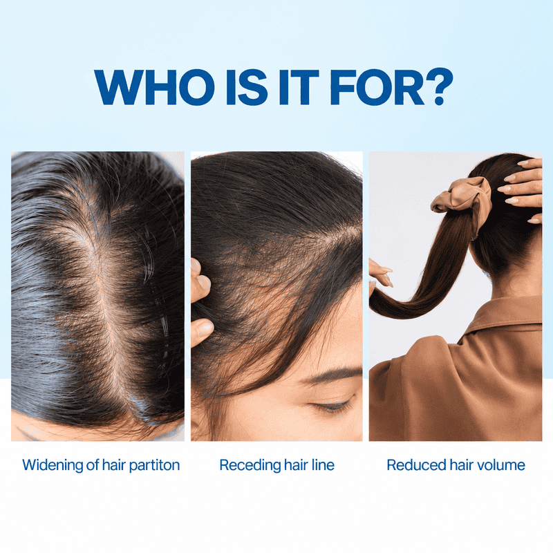 Be Bodywise Hair Growth Serum Roll On, 25 ml 2 Be Bodywise Hair Growth Serum Roll On, 25 ml - Image 2