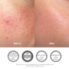 Dr Althea Pro Lab 345 Relief Cream 800x800 001